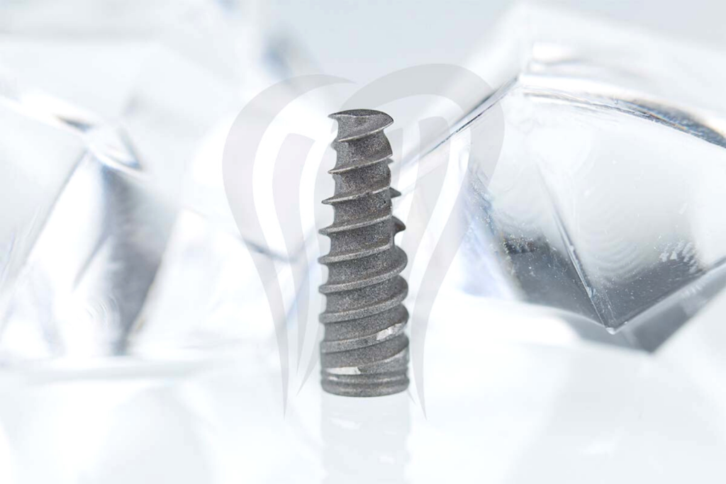 Titanski vijak - zubni implantat