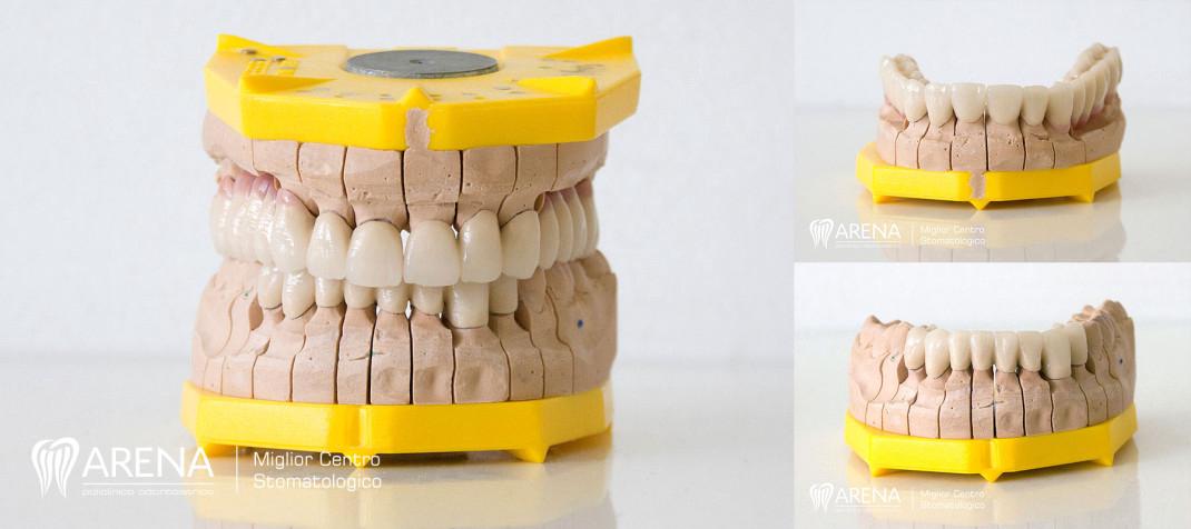 Prikaz zubnih krunica na modelu.