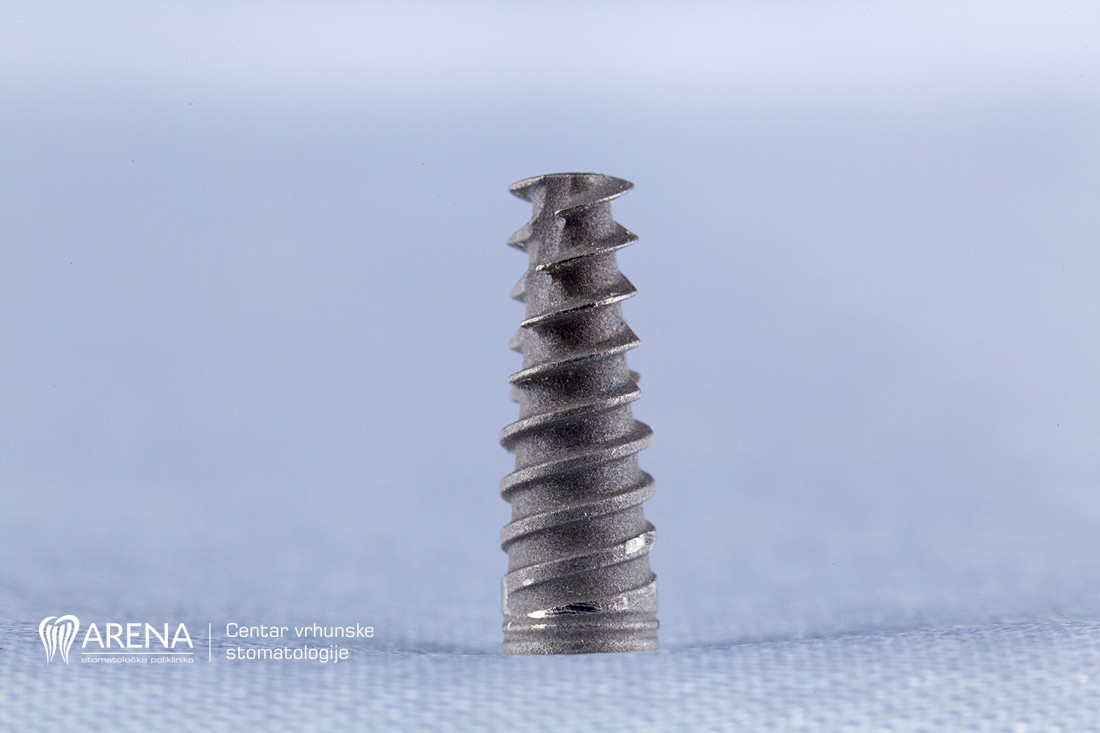 Titanski vijak koji mjenja krojen zuba.