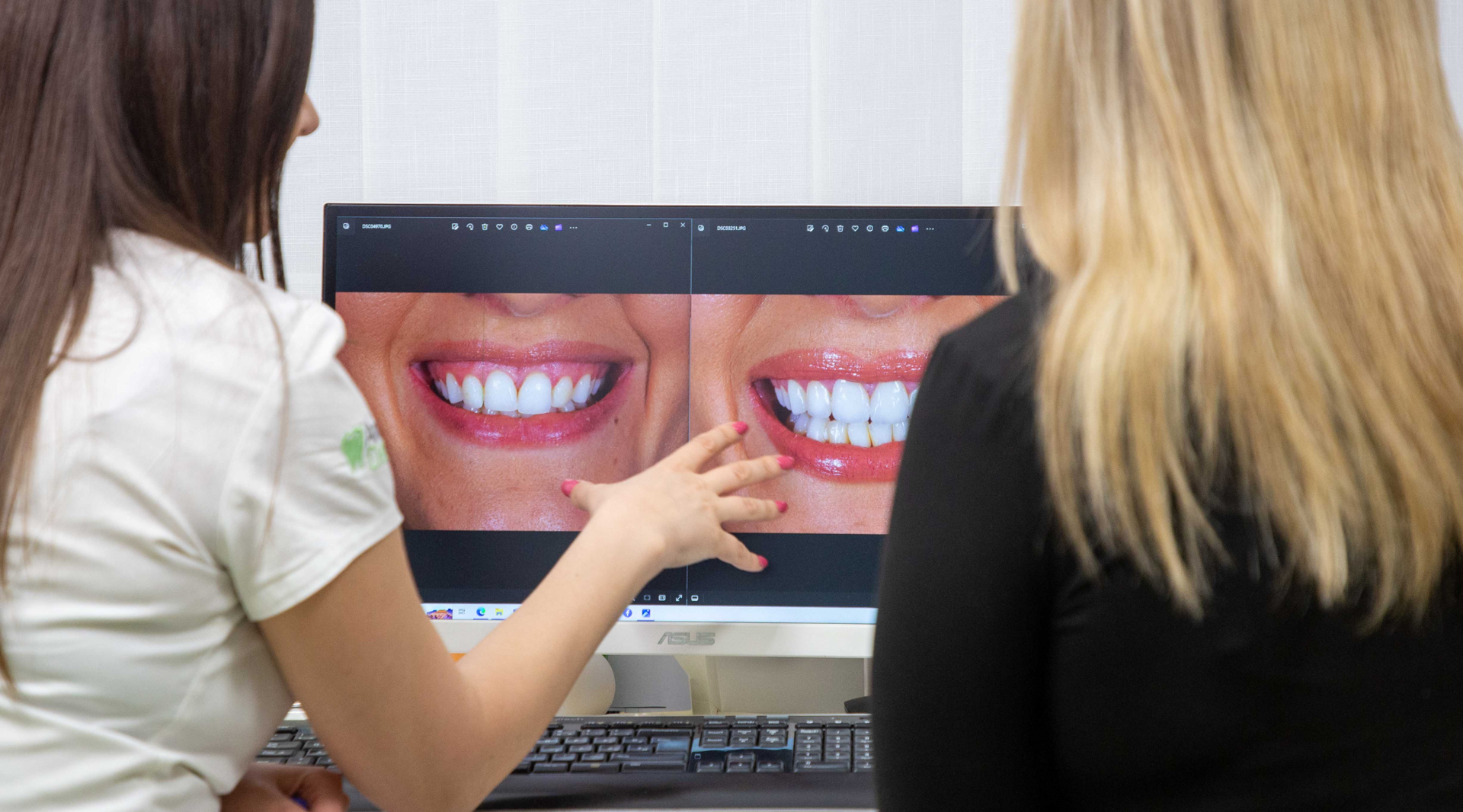 Sretan pacijent kojem je vraćena estetika osmijeha brzim i sigurnim zahvatima stručnog osoblja