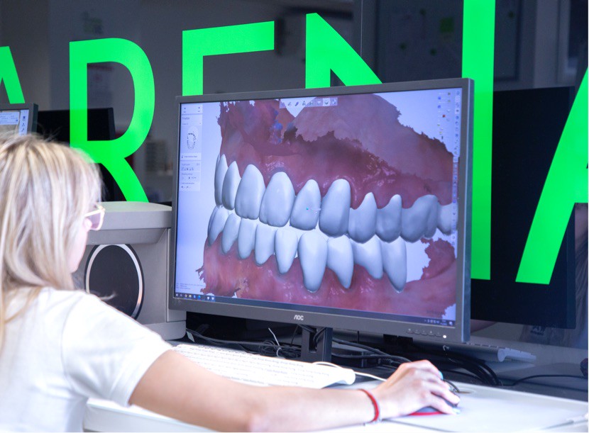 CAM-CAD izrada akrilat totalne proteze