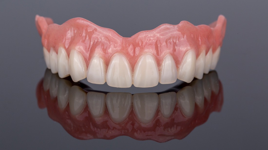 Privikavanje pacijenta na fiksnu zubnu protezu.