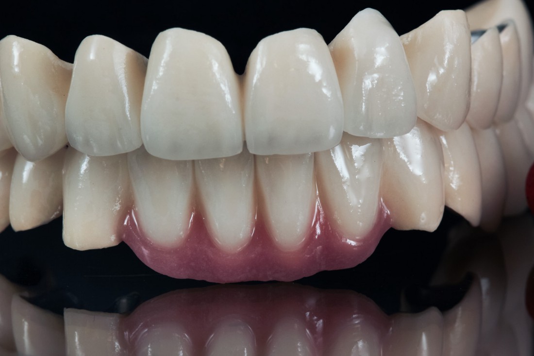 Cirkularni most i kombi rad.