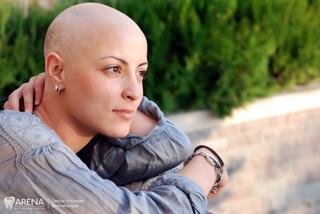 Žena koja ide na kemoterapiju.
