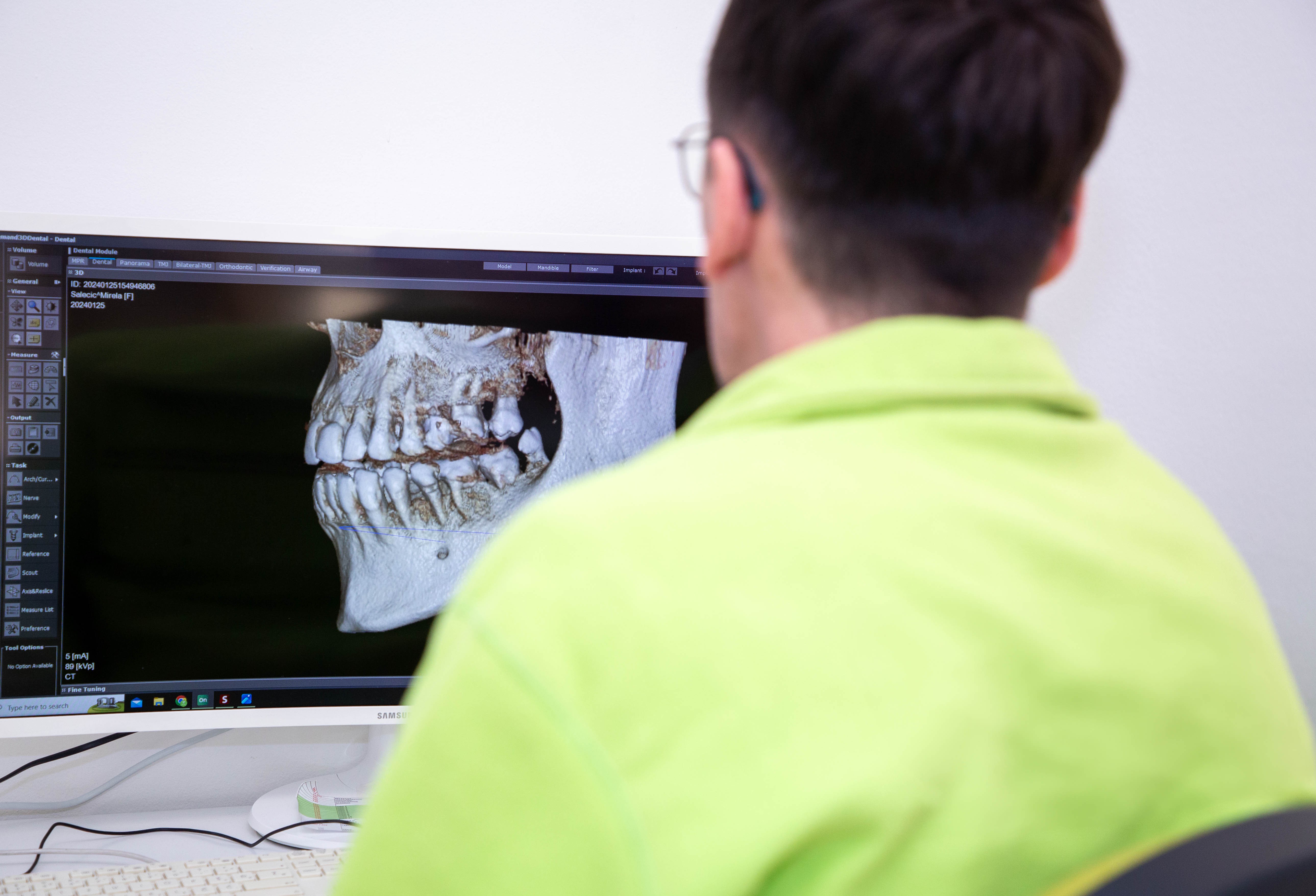 Priprema za CBCT snimanje zuba