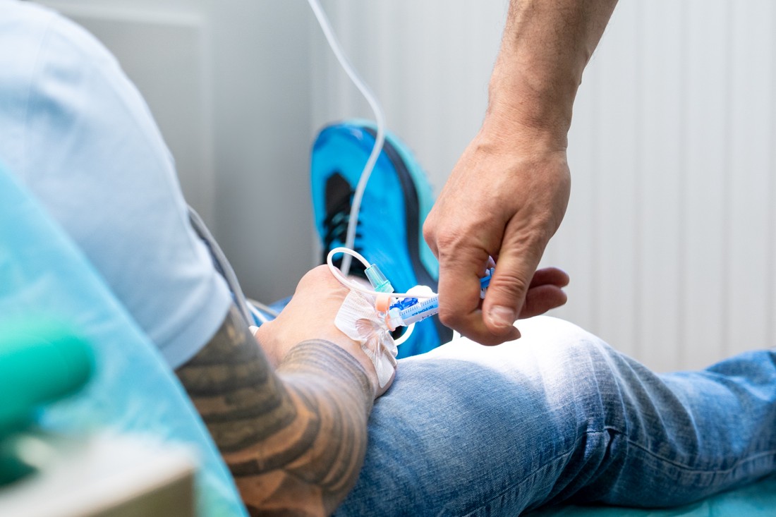 Potpune cirkonske zubne krunice na modelu.