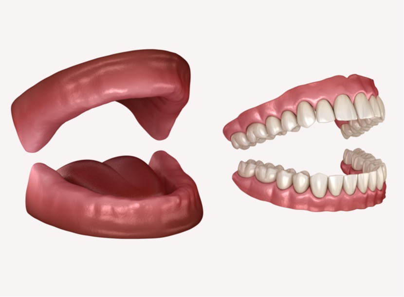 Medicinski precizna 3D ilustracija mobilnih proteza