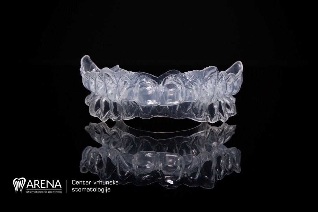 Udlage stomatološke poliklinike Arena Dental .