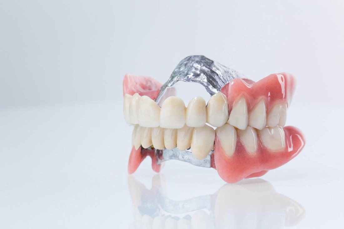 Mobilna zubna proteza wironit.