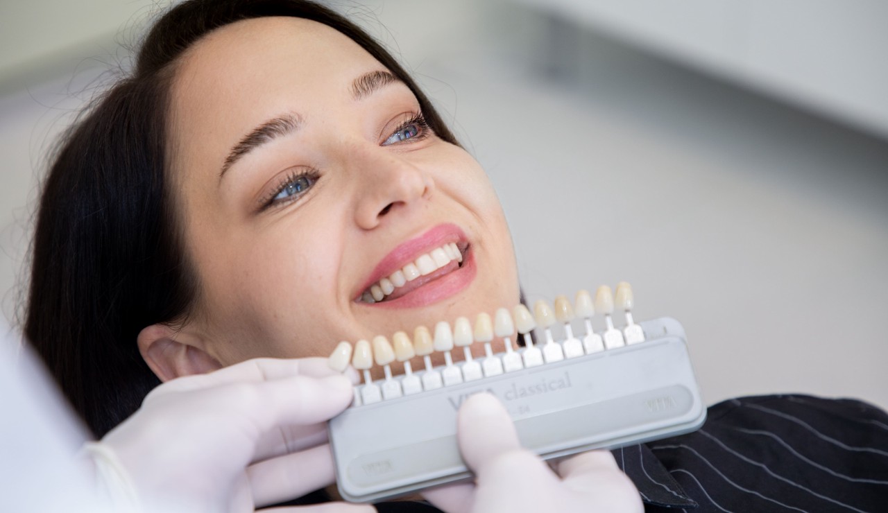 Zubne krunice - blog - 3