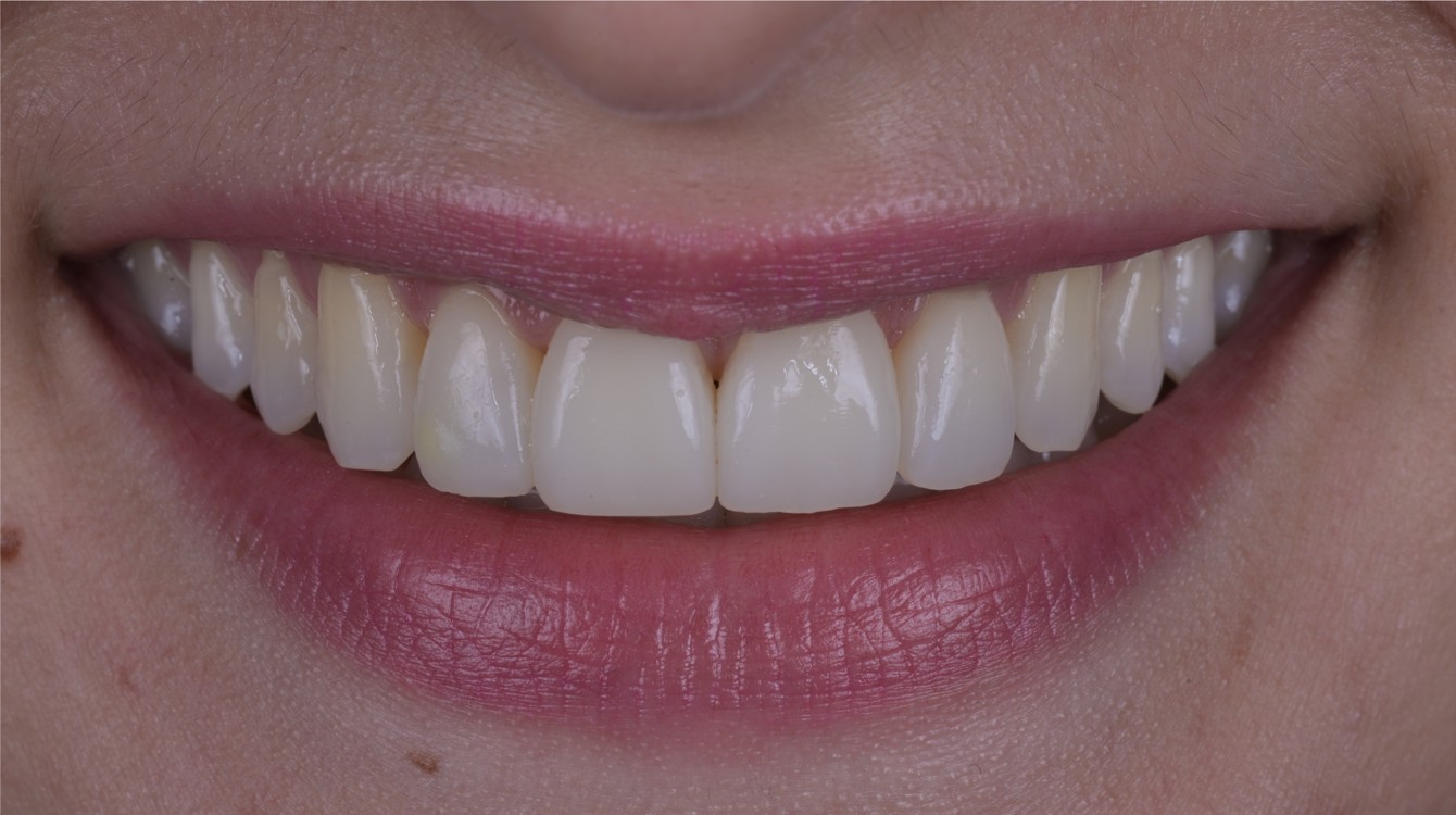 makeover_7_helena_teeth_after