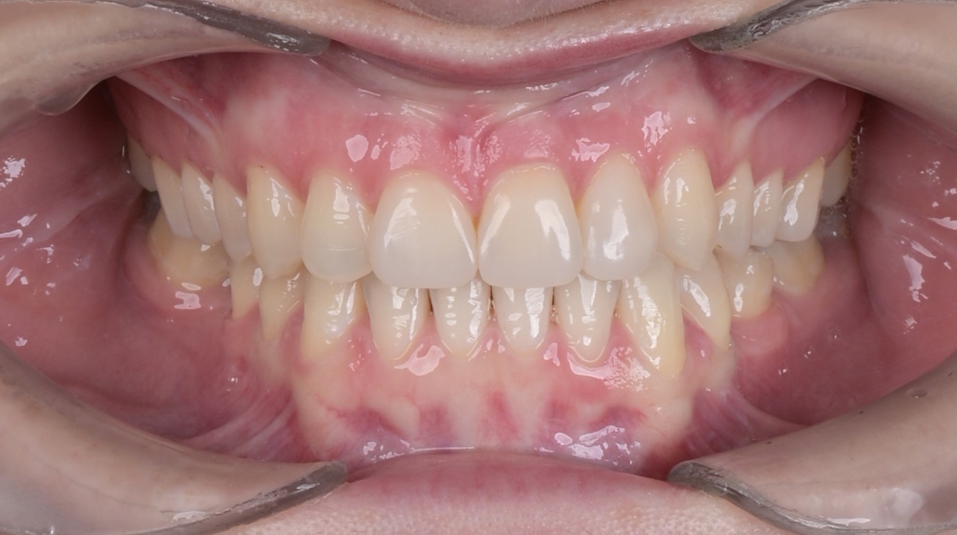 makover_1_ana_teeth_after