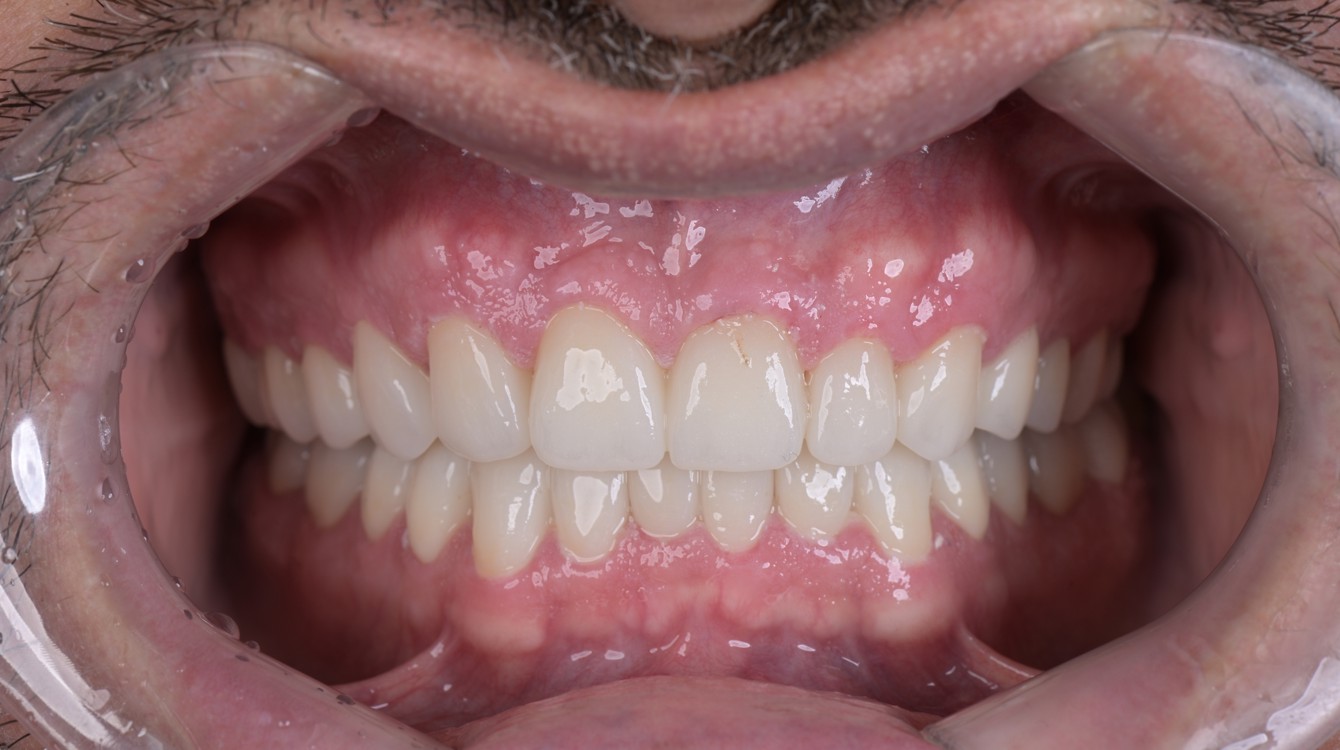 makeover_3_emin_teeth_after