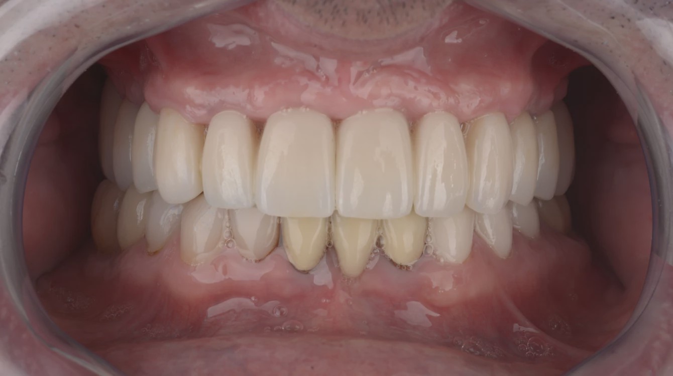 836dbfe4f36f7afda0711844d9b4eebe