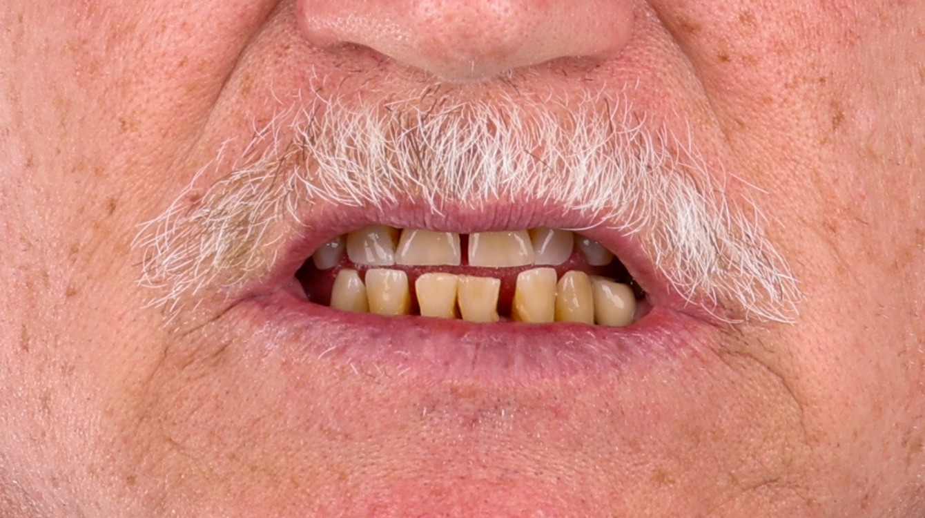 James Hennesey-before_closeup