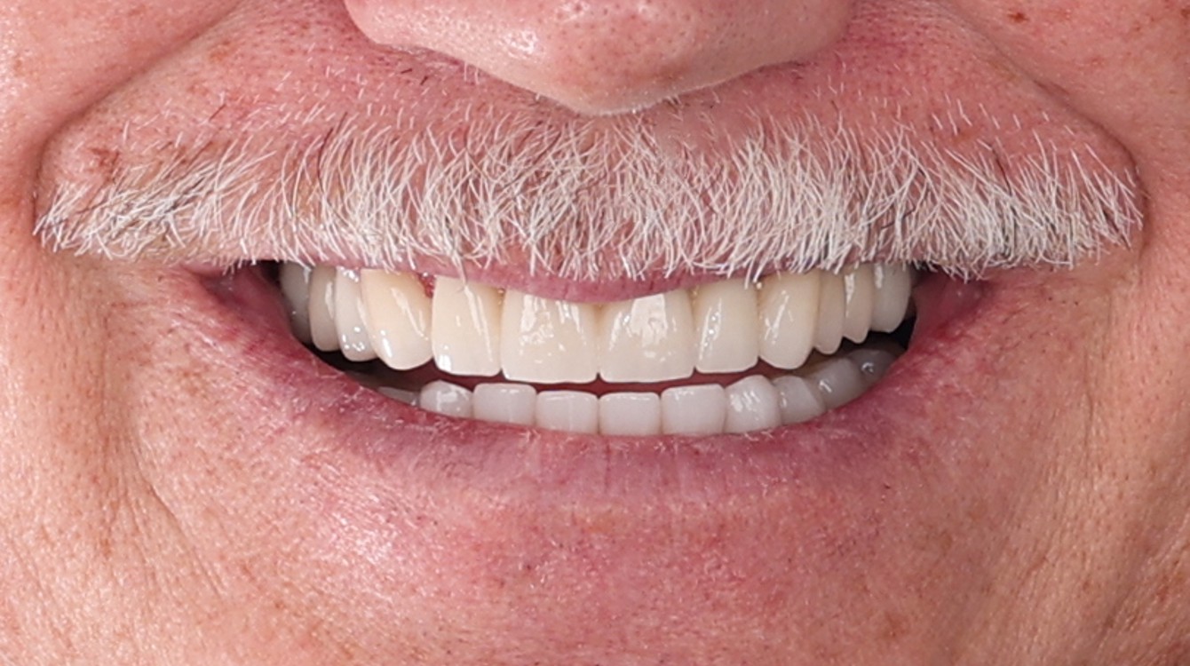 James Hennesey-after_closeup