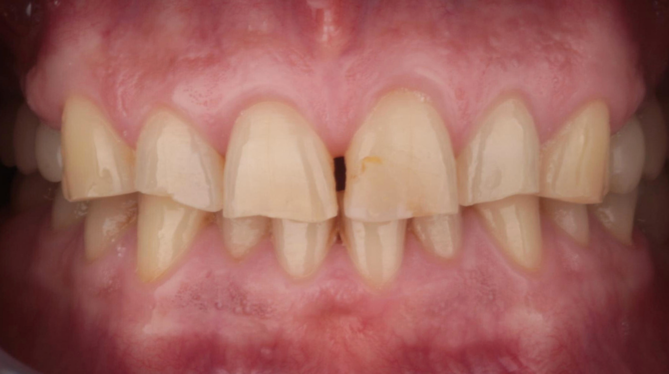 Arena - FB 1025 (36)