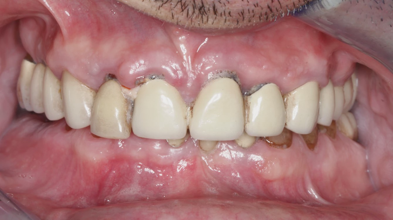 388cd6a37e3e3f96b65da3aec6a68c01