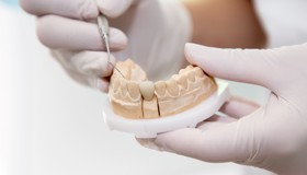 Zubne krunice - blog - 1