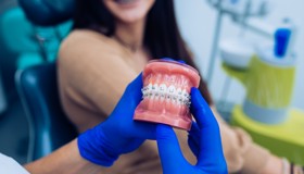 Fiksna ortodoncija_full