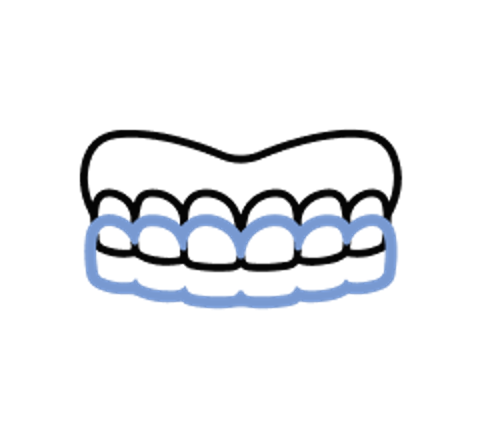 invisalign