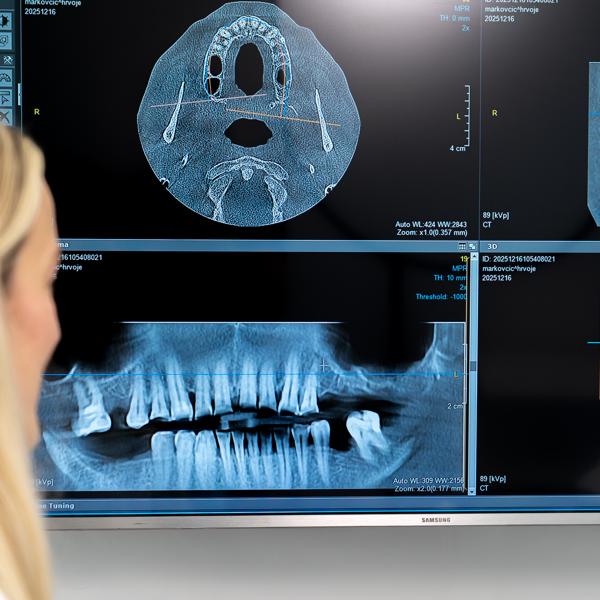 ICM - fotkanje za web-34