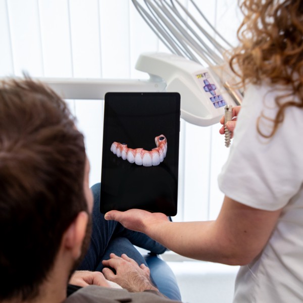 ALL-ON-4 ALL ON 6_about