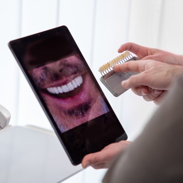 Mobilne proteze - Koje su prednosti mobilne proteze