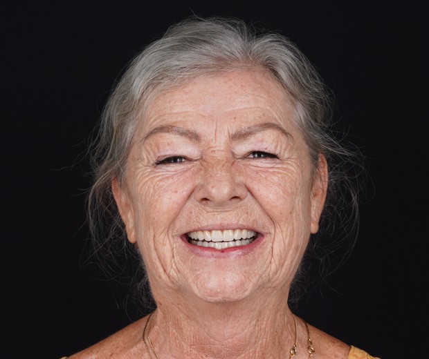 Pacijentica s osmijehom nakon završenog protetskog rada, prikazuje konačni estetski rezultat i transformaciju osmijeha.