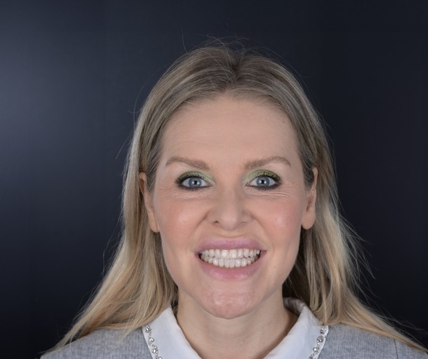 makeover_6_gorana_full_before