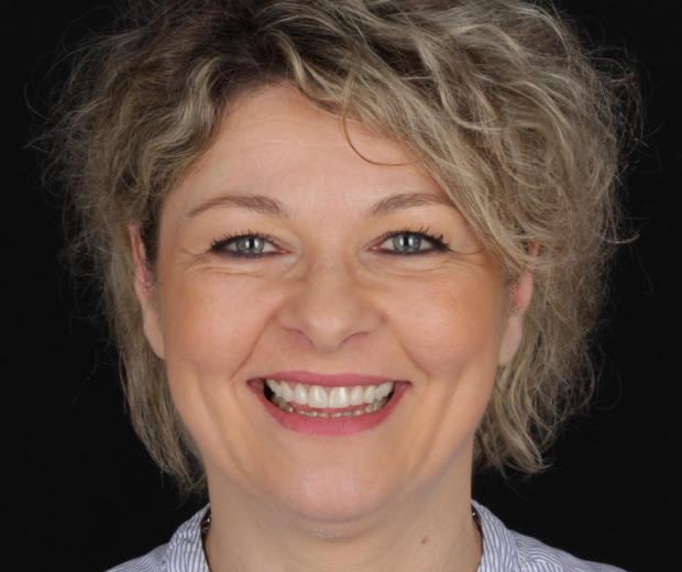 BlogMakover Rident  (6)