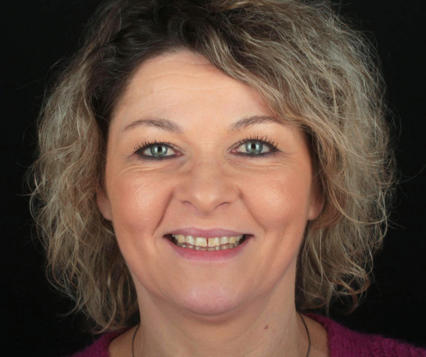 BlogMakover Rident  (8)