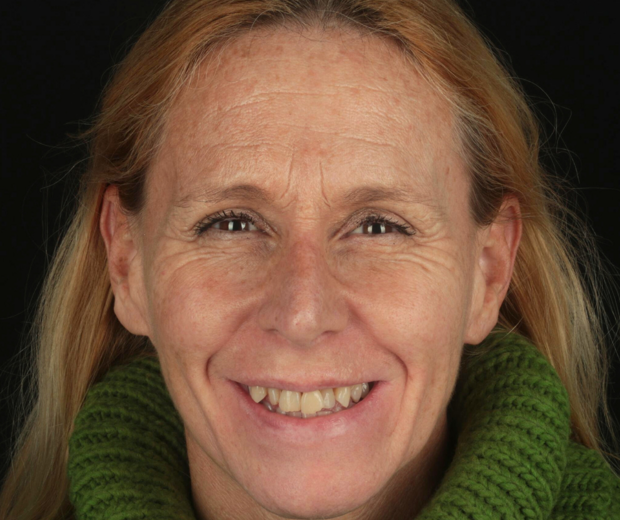 BlogMakover Rident  (9)