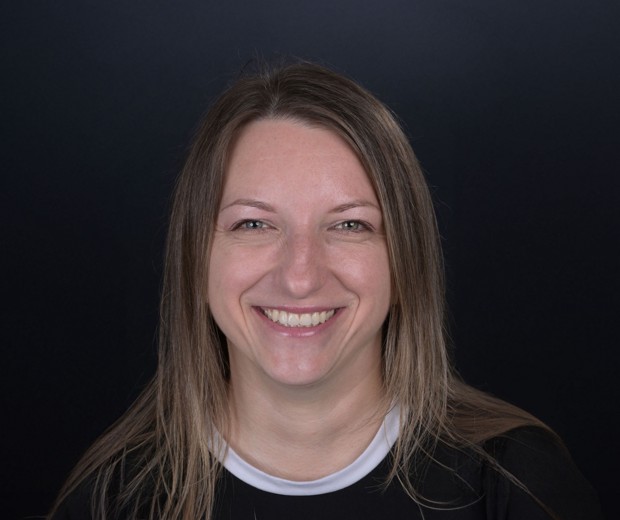 ortodoncija-i-sms-Ana-full-after