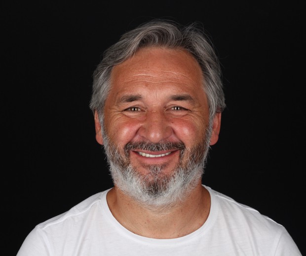 Portret pacijenta nakon implantološke terapije i estetske rekonstrukcije pomoću cirkonskih krunica, s prirodnim, skladnim i funkcionalno obnovljenim osmijehom.