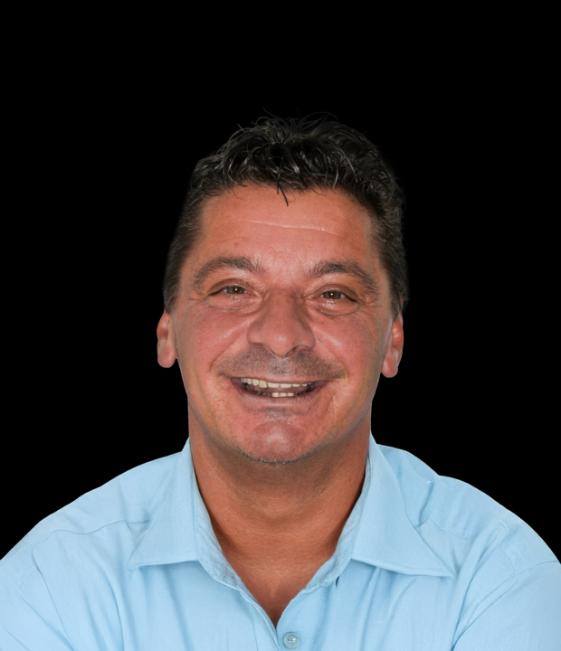 Portret pacijentice prije funkcionalno-estetske rehabilitacije s implanto-protetskom terapijom, s vidljivim početnim stanjem osmijeha i zubi.