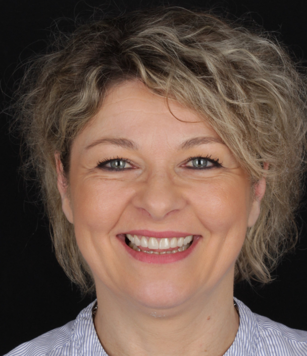 BlogMakover Rident  (6)