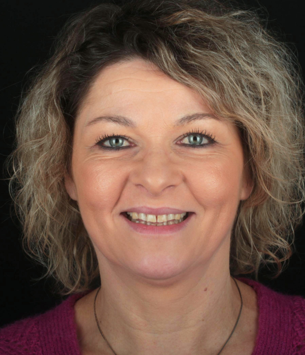 BlogMakover Rident  (8)