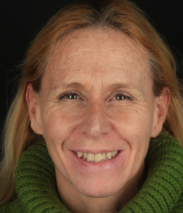 BlogMakover Rident  (9)