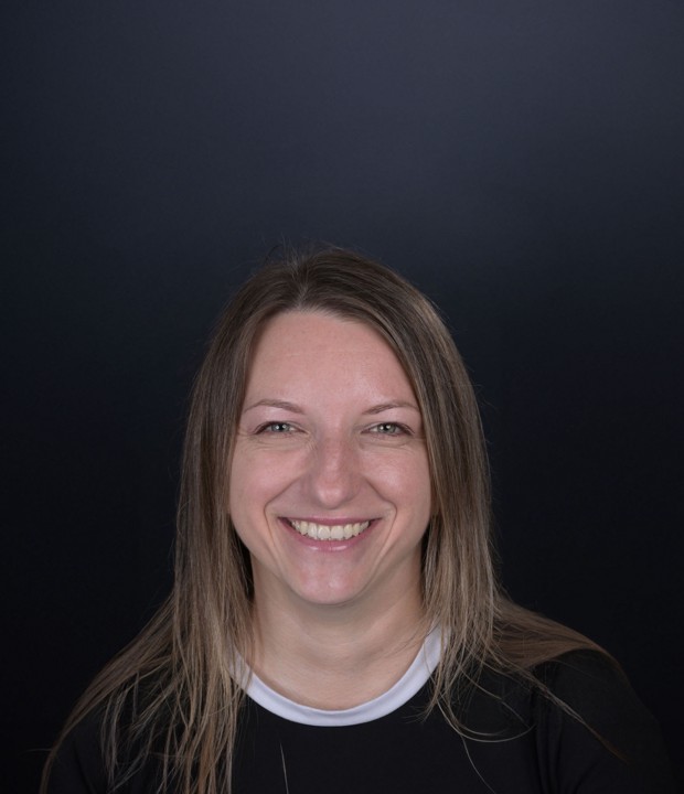 ortodoncija-i-sms-Ana-full-after