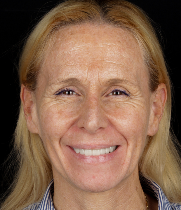 BlogMakover Rident  (10)