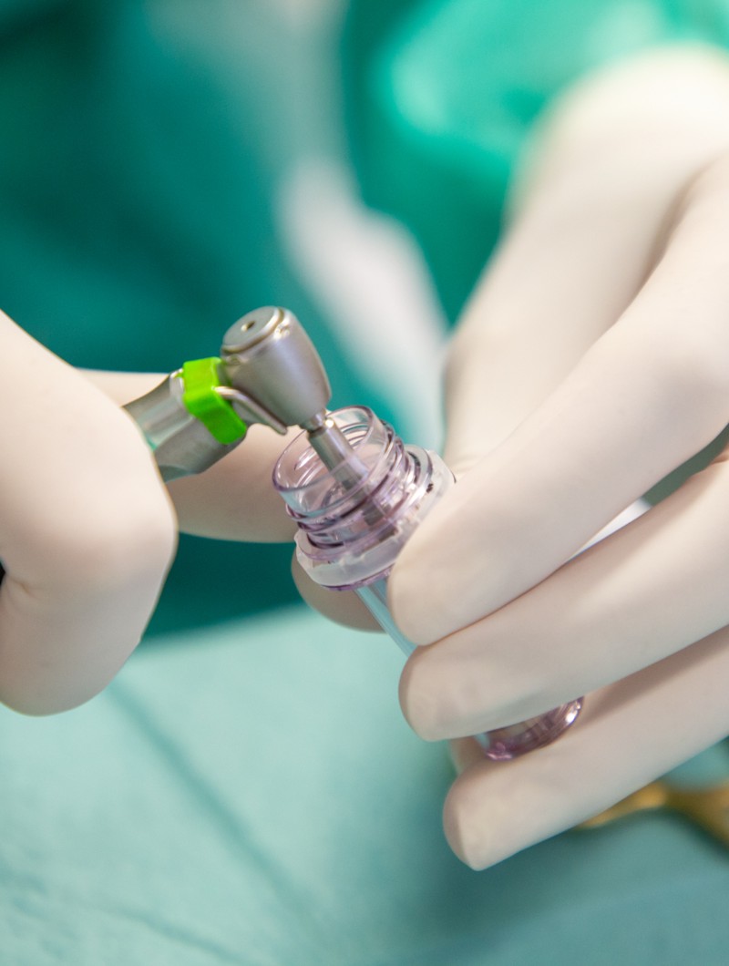 dentalni_implantati