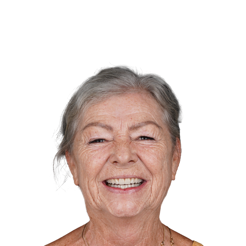 Portret nasmijane pacijentice s prikazom Digital Smile Designa, koji vizualizira konačni izgled njezina budućeg osmijeha.