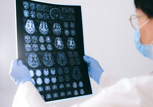 Centar za glavobolje