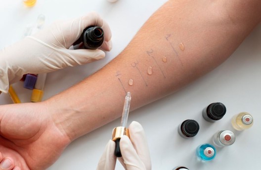 Alergologija i klinička imunologija